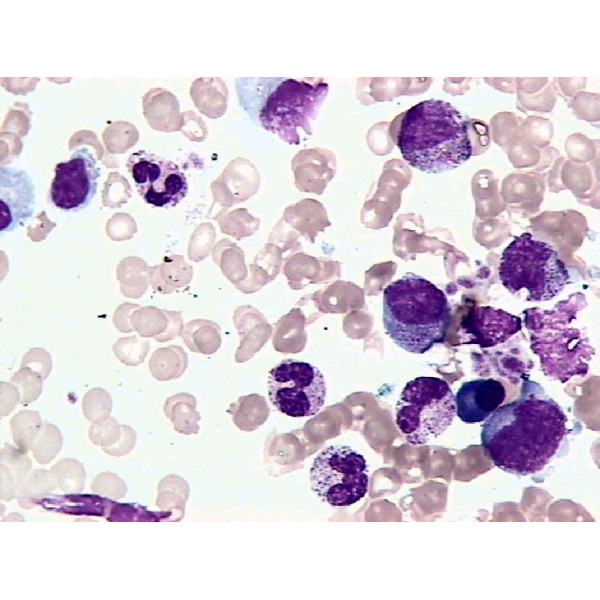 SV40转染人成骨细胞,hFOB1.19细胞