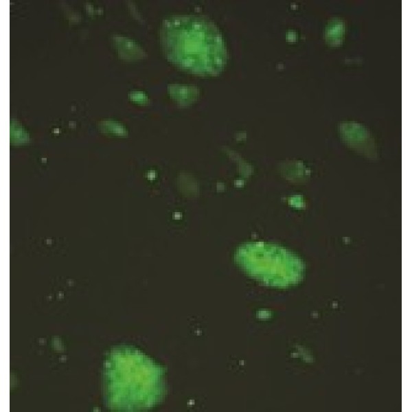 绿色荧光蛋白标记小鼠子宫颈癌细胞