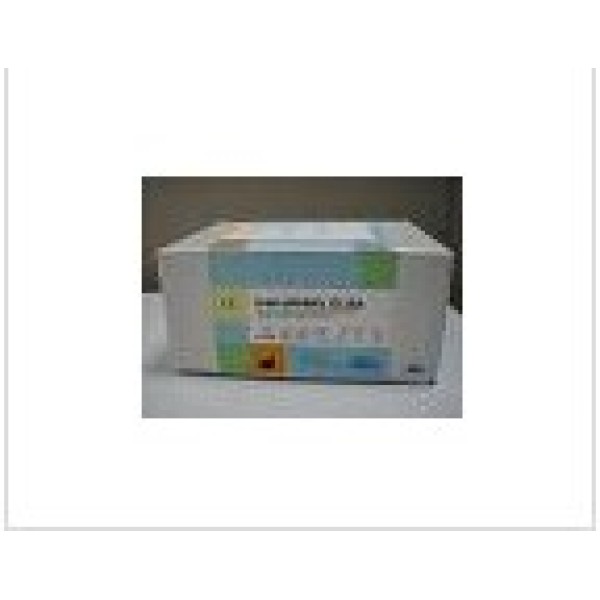 人肌肉肌酸激酶(CKM)ELISA试剂盒 