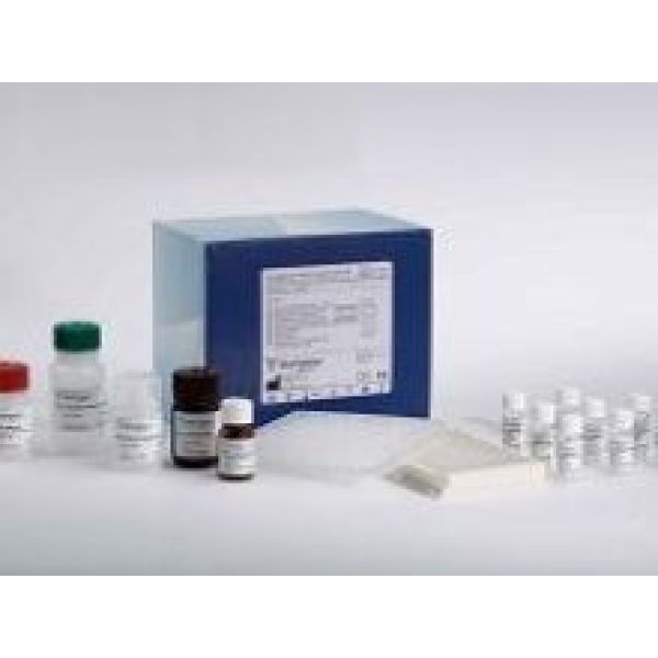 人麻疹病毒IgM(MV IgM)ELISA试剂盒 