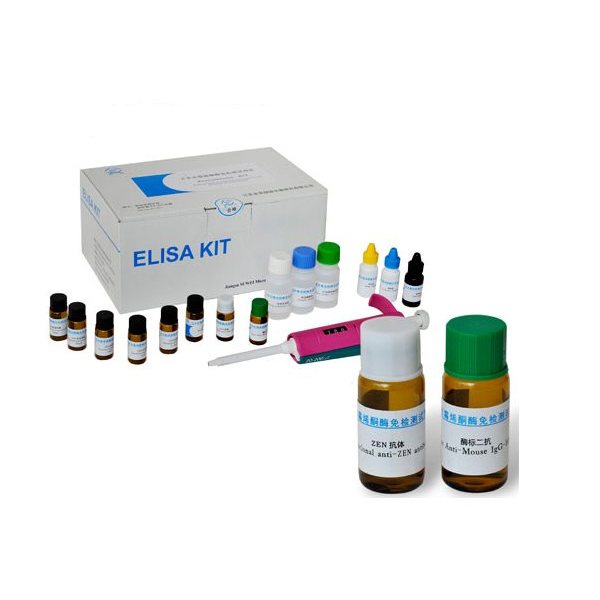 解脲脲原体抗体检测试剂盒