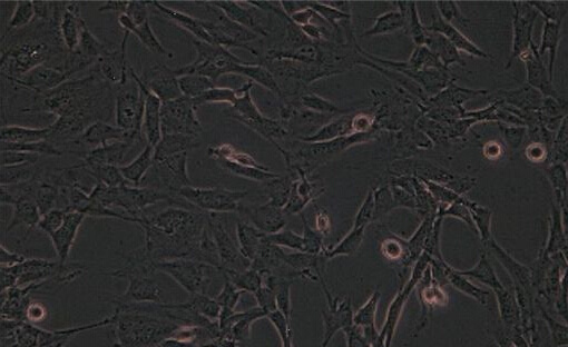 (KB细胞)人口腔表皮样癌细胞
