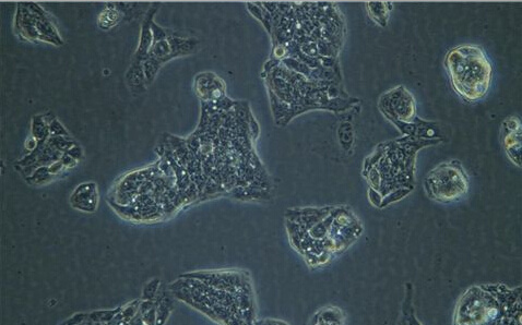 (CNE细胞)人鼻咽癌细胞
