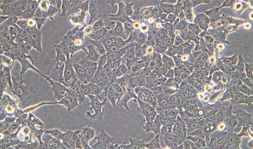 (成纤维细胞HFTF细胞)人胚胎眼Tenon囊