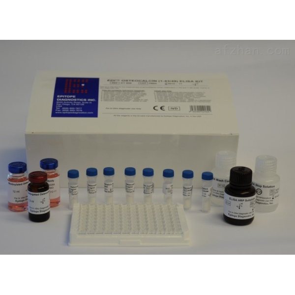人抗SSB/La抗体检测试剂盒
