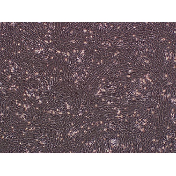 CFPAC-1    人胰腺癌细胞
