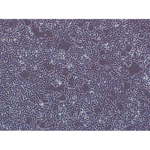 大鼠胶质瘤细胞