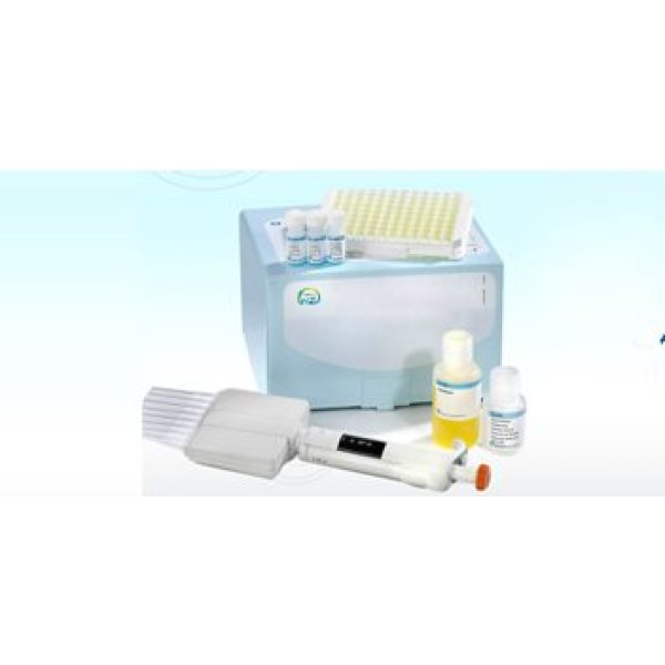 人免疫球蛋白A（IgA）检测试剂盒