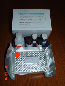 人MCP-1/CCL2/MCAF试剂盒