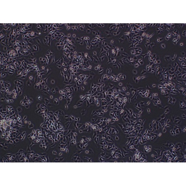 HT-1080细胞;人纤维肉瘤细胞