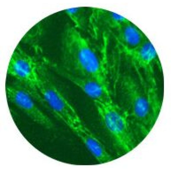 RF/6A细胞;猴脉络膜-视网膜内皮细胞
