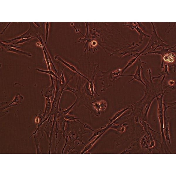 Sp2/0-Ag14细胞;小鼠骨髓瘤细胞
