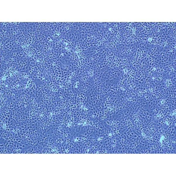 NCI-H524细胞;人非小细胞肺癌细胞