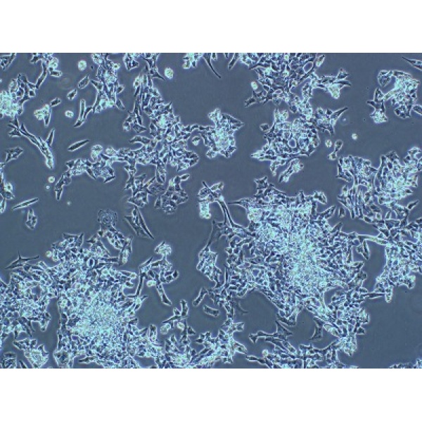 PC-3M IE8细胞;人前列腺癌高转移细胞株