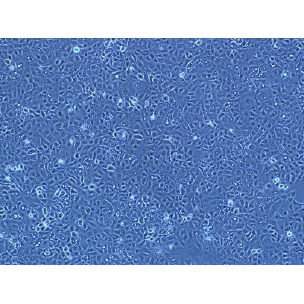 H-97细胞;人高转移肝癌细胞