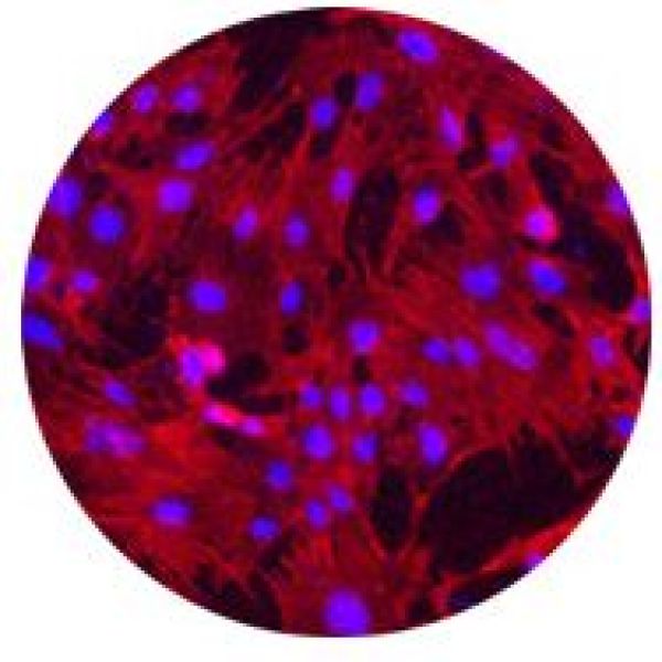 SK-N-BE细胞;人神经母细胞瘤细胞