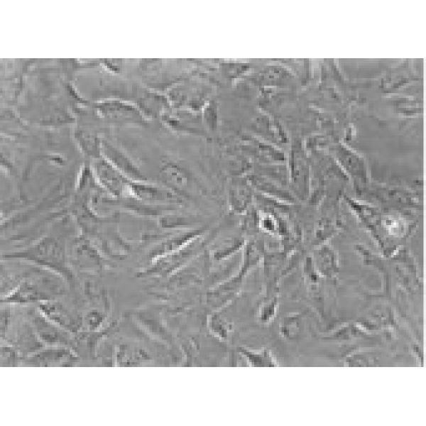 MDA-MB-415细胞;人乳腺癌细胞