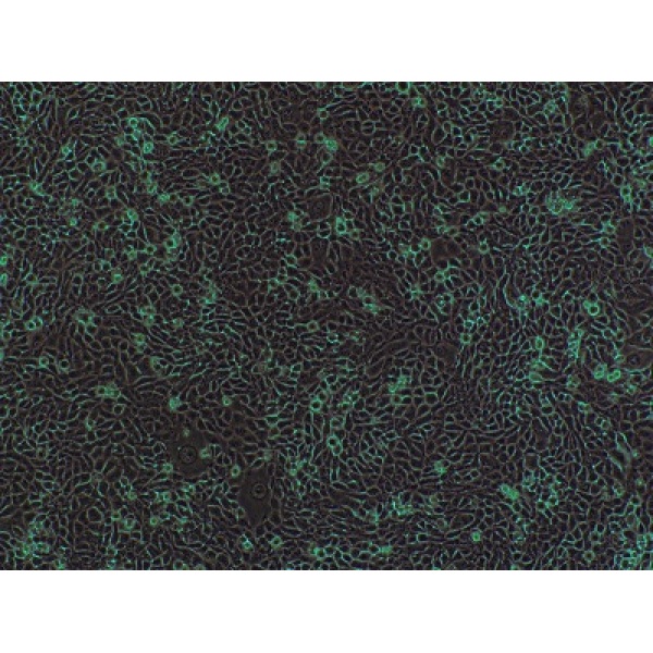 SW 780细胞;人膀胱移行细胞癌