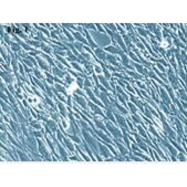 A2780细胞;人卵巢癌细胞