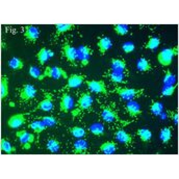 WERI-Rb-1细胞;人视网膜神经胶质瘤细胞
