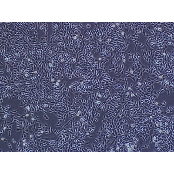 EA.hy926细胞;人脐静脉细胞融合细胞