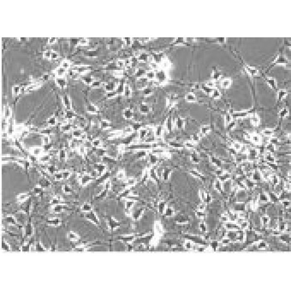 RT4细胞;人膀胱移行细胞乳头瘤细胞