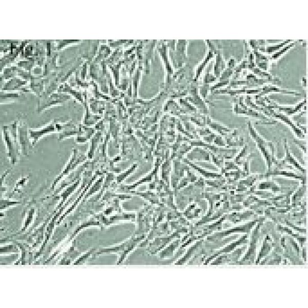 OKT 11细胞;小鼠杂交瘤细胞