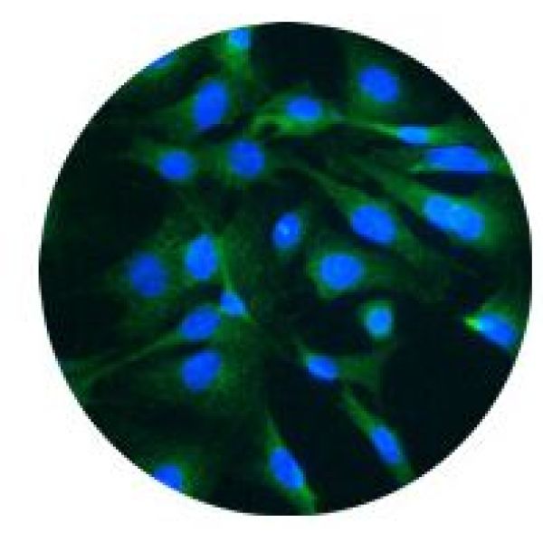 MuM-2B细胞;人侵袭性脉络膜黑色素瘤细胞