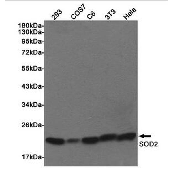 Anti-SOD2抗体