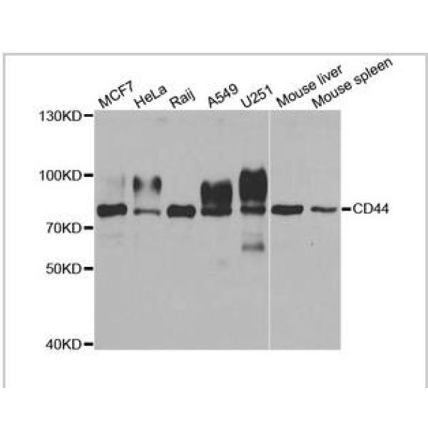 Anti-CD44抗体