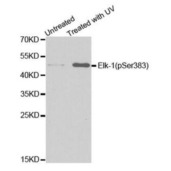 Anti-Phospho-ELK1-S383抗体