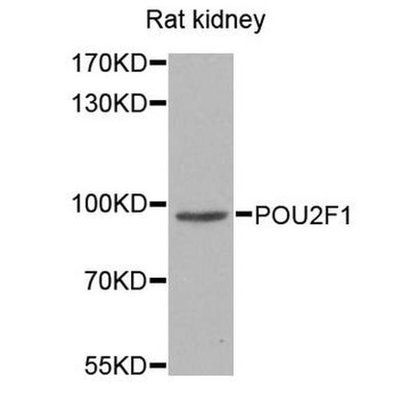 Anti-POU2F1抗体
