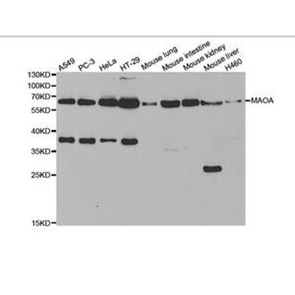 Anti-MAOA抗体