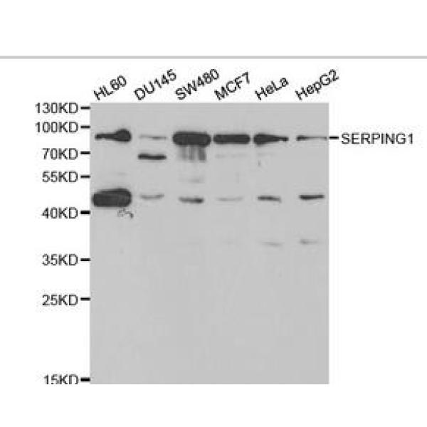 Anti-SERPING1抗体
