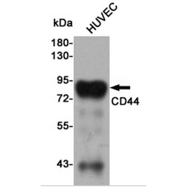Anti-CD44 抗体