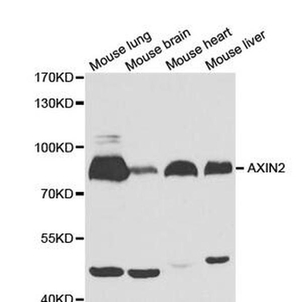Anti-AXIN2抗体