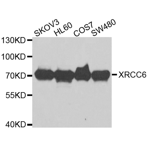 Anti-XRCC6抗体