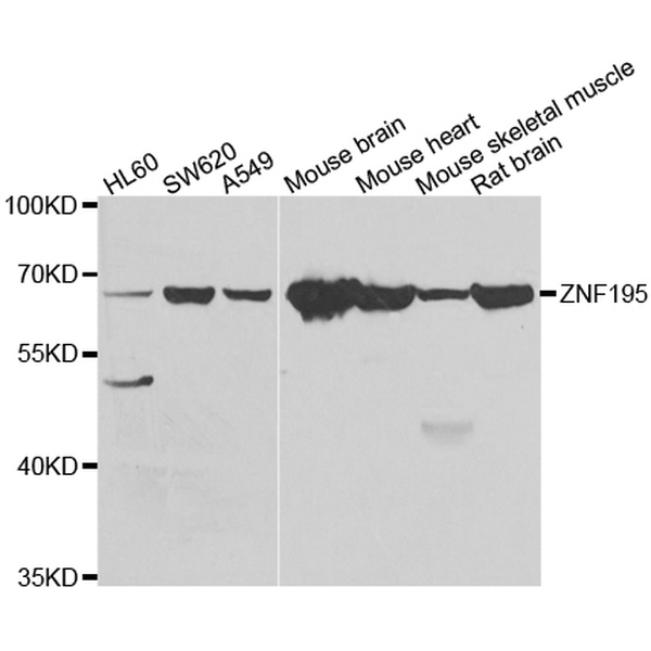 Anti-ZNF195抗体