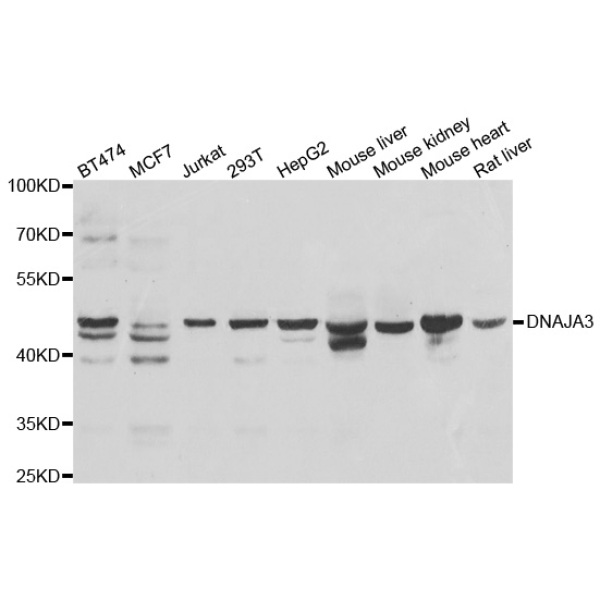 Anti-DNAJA3抗体