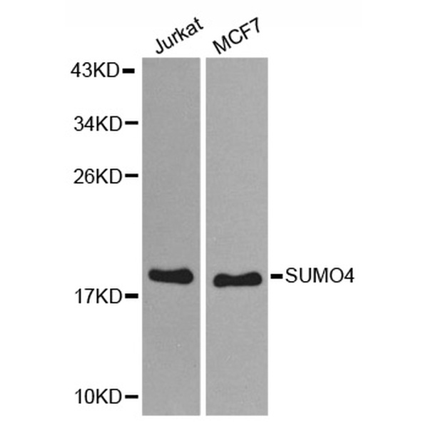 Anti-SUMO4抗体