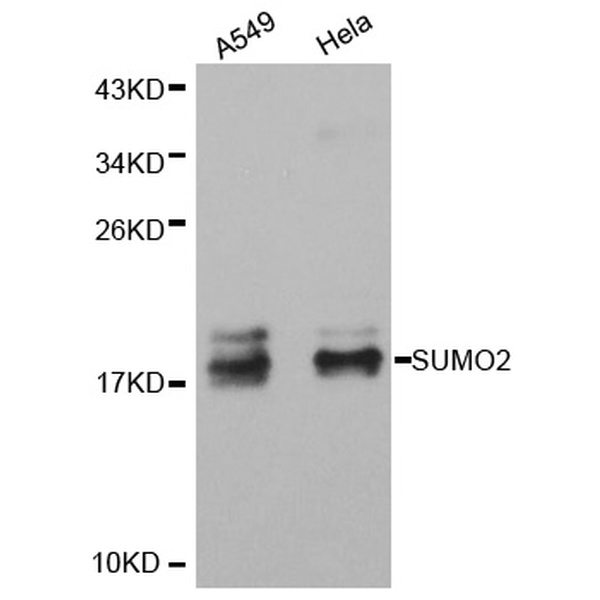 Anti-SUMO2抗体