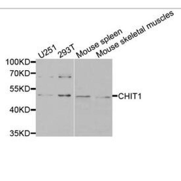 Anti-CHIT1抗体