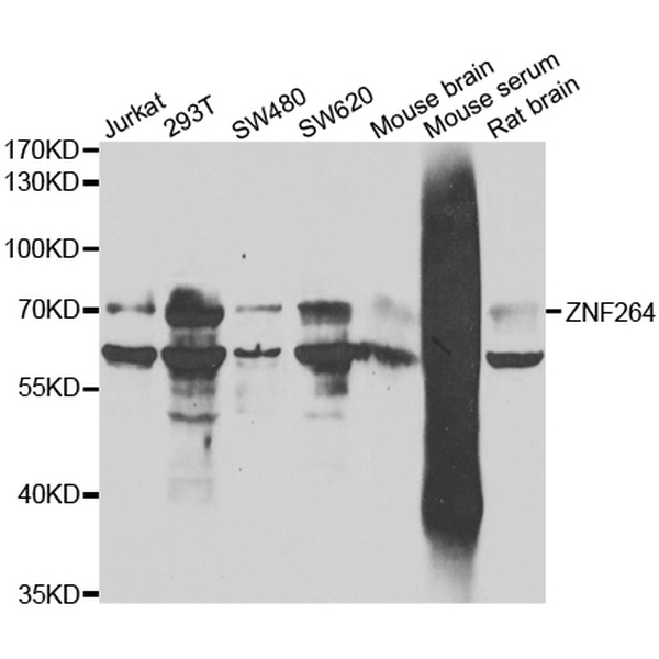 Anti-ZNF264抗体