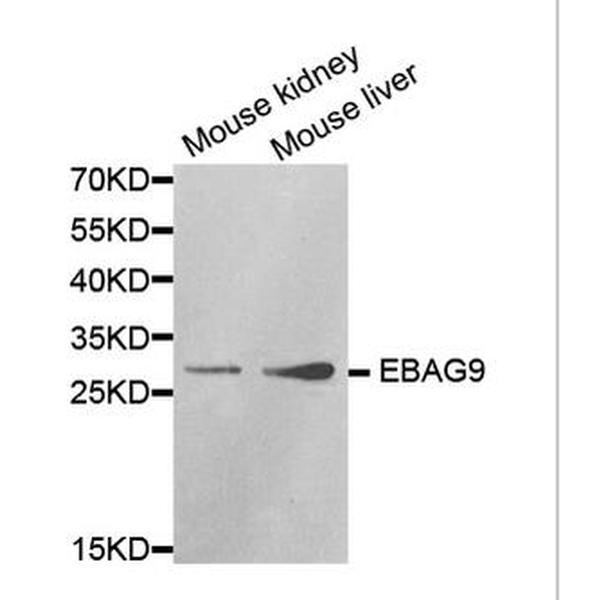 Anti-EBAG9抗体