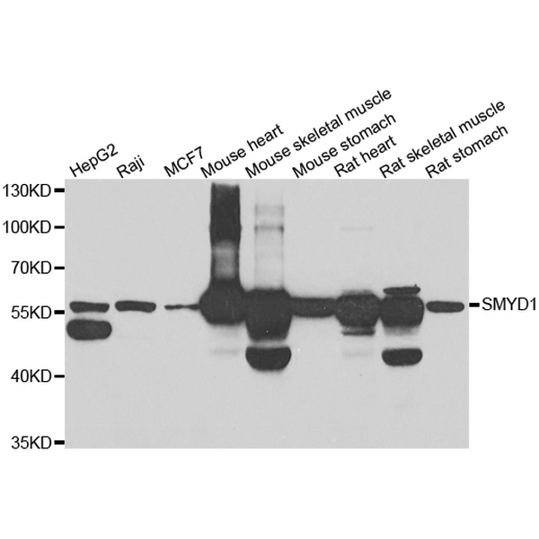 Anti-SMYD1抗体