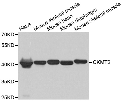 Anti-CKMT2抗体