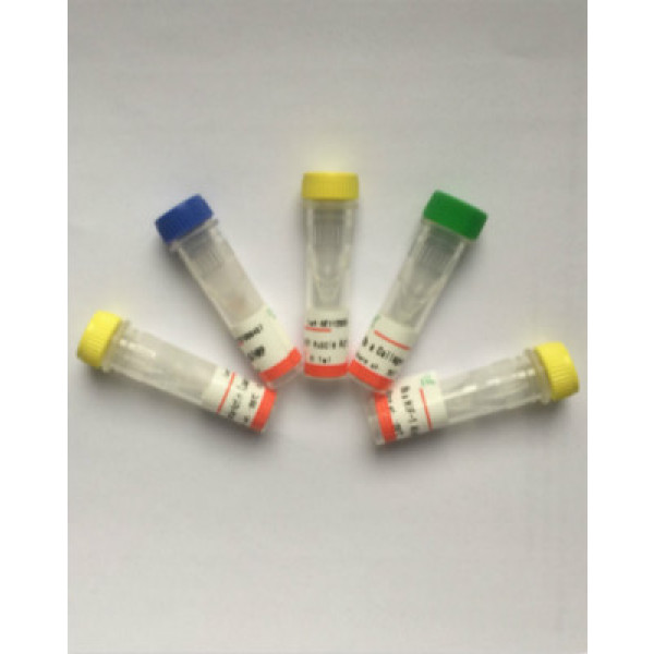 大鼠血红素氧合酶2(HO-2)ELISA试剂盒性能优点