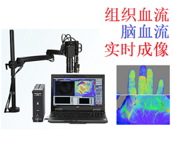 组织血流成像仪