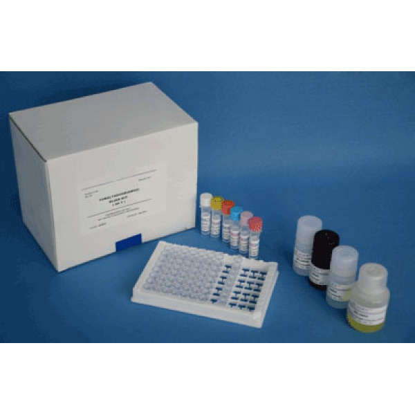 人优球蛋白(EL)ELISA试剂盒检测步骤