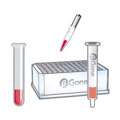 &#946;-Gone&#8482; &#946;-葡萄糖苷酸酶去除产品